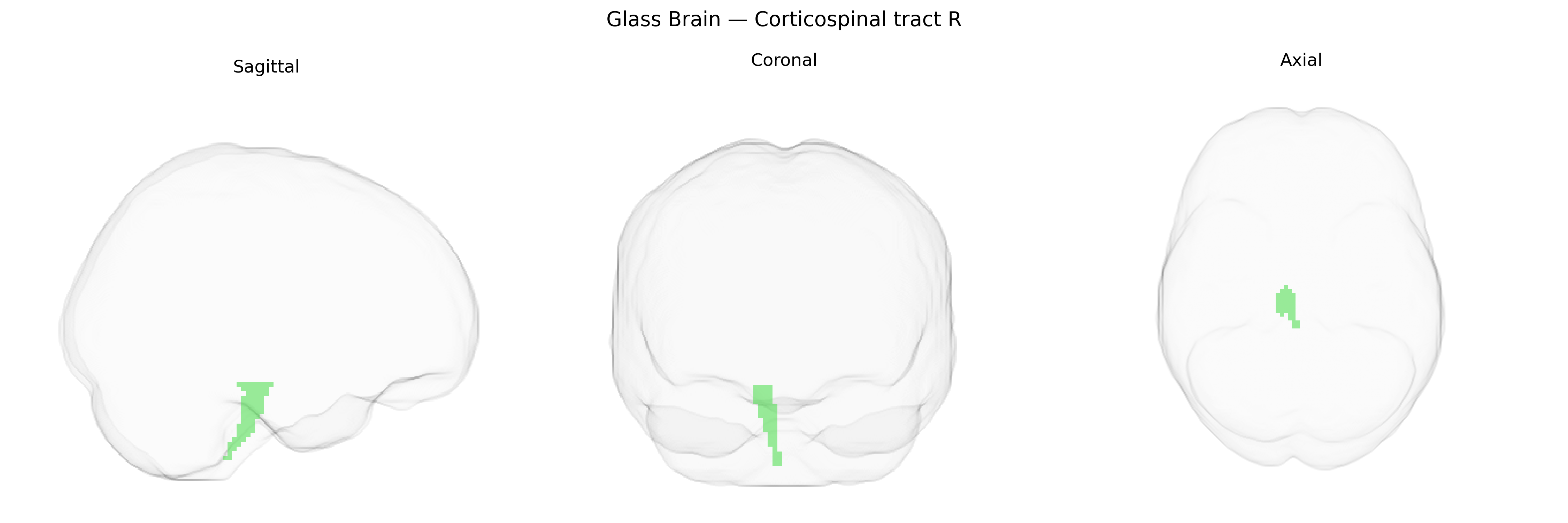 Triplanar Ghost Brain
