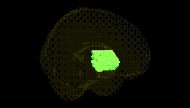 Full Brain Black