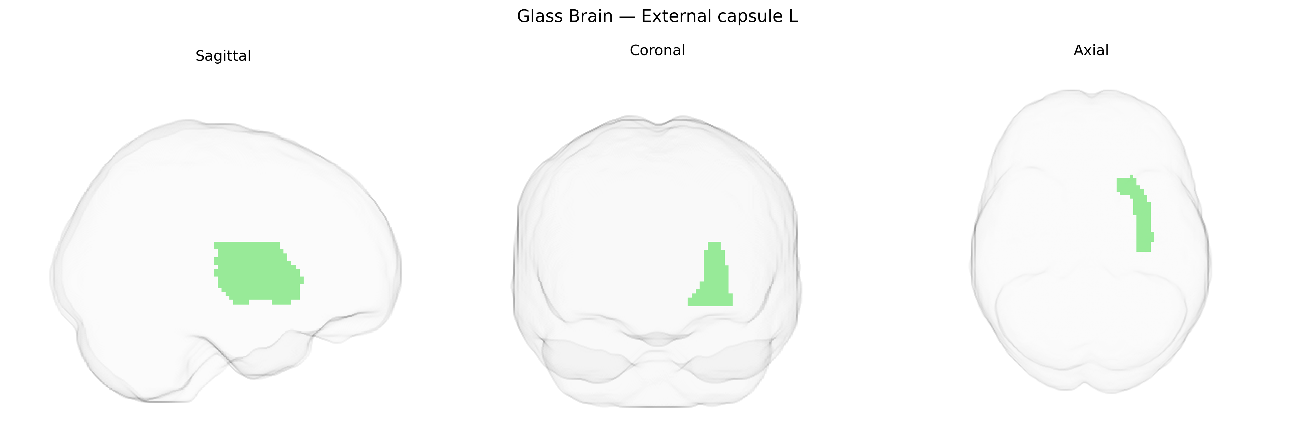 Triplanar Ghost Brain