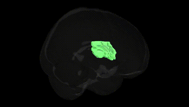 Full Brain Black