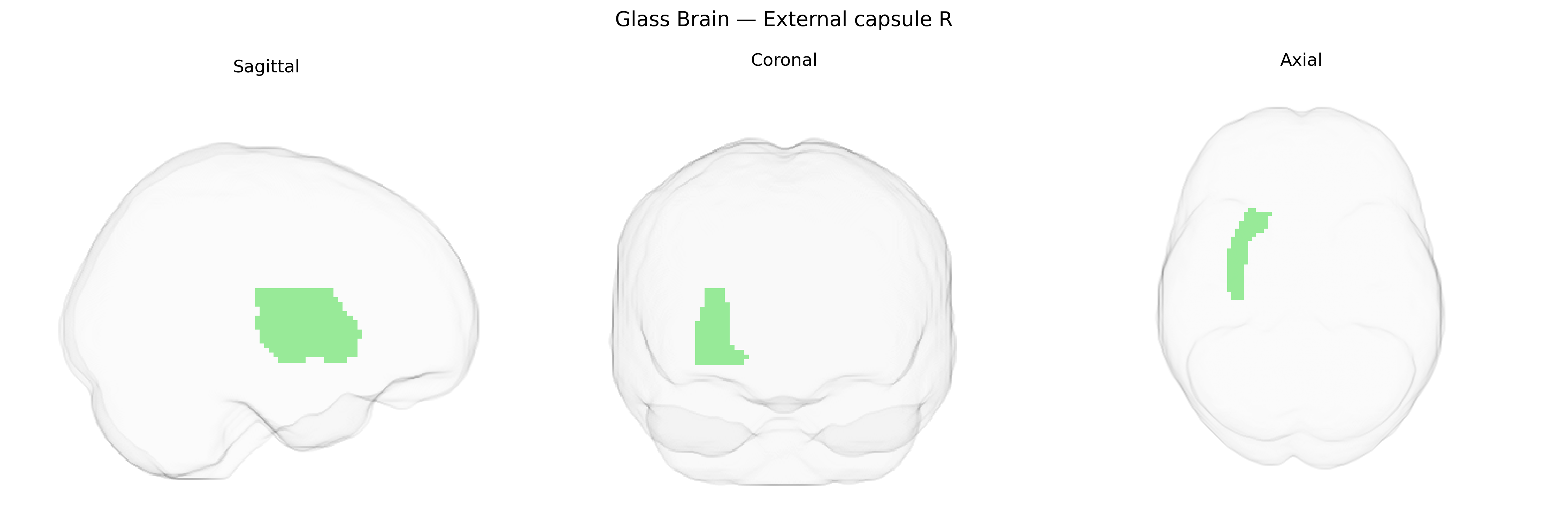 Triplanar Ghost Brain