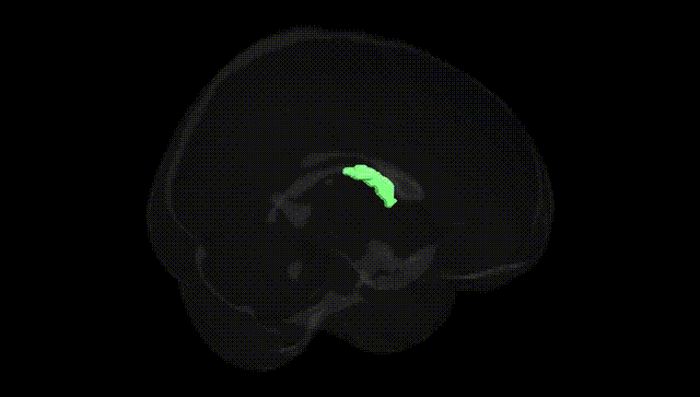 Full Brain Black