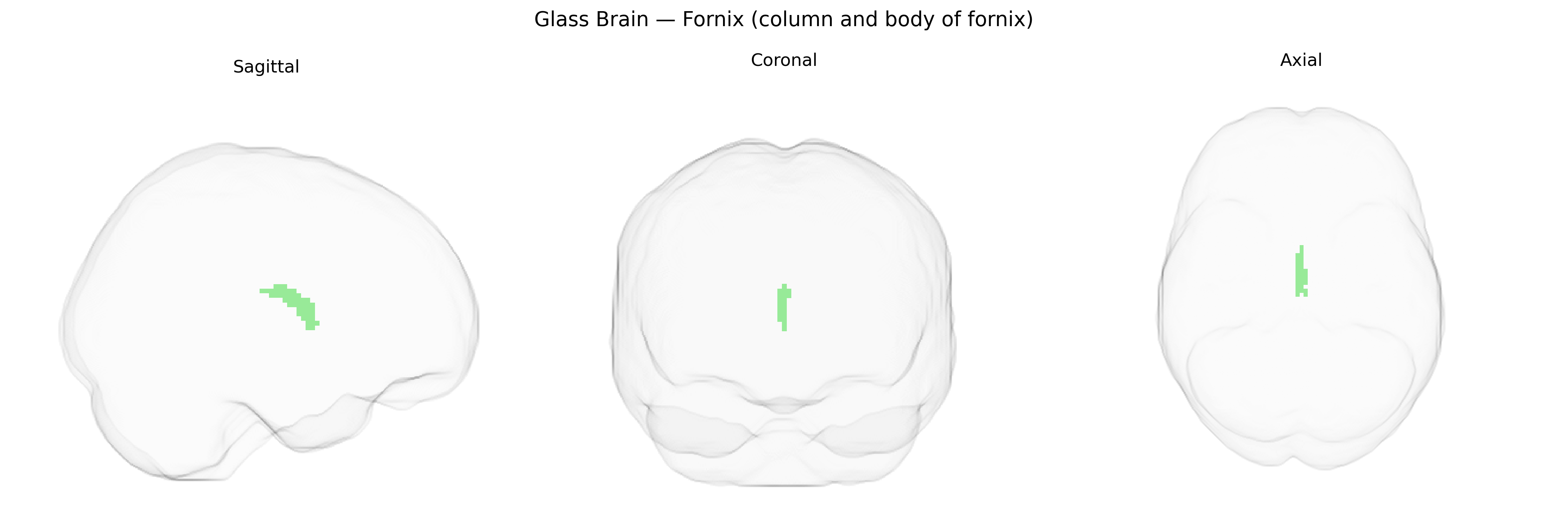 Triplanar Ghost Brain