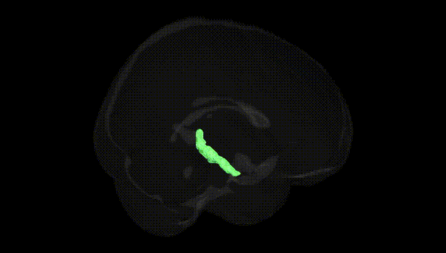 Full Brain Black
