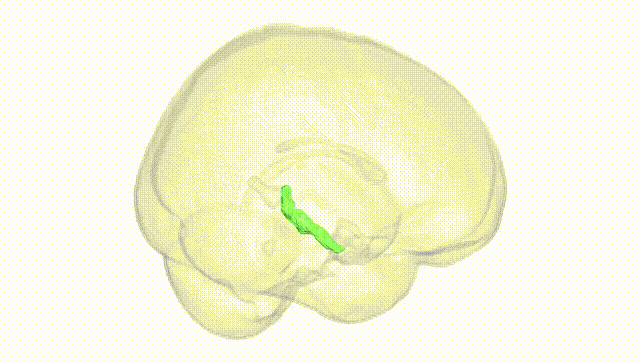 Full Brain White
