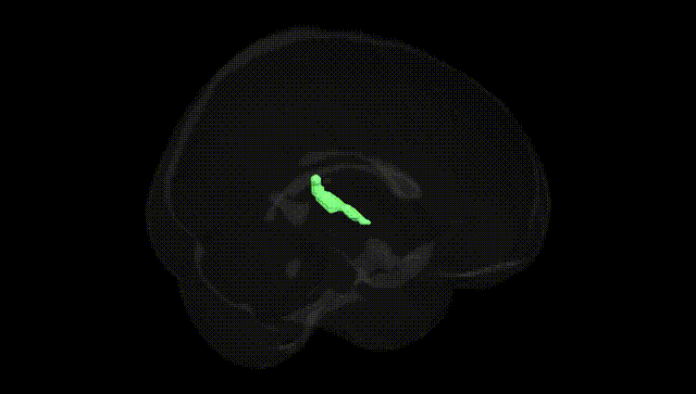 Full Brain Black