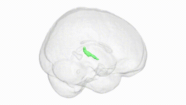 Full Brain White