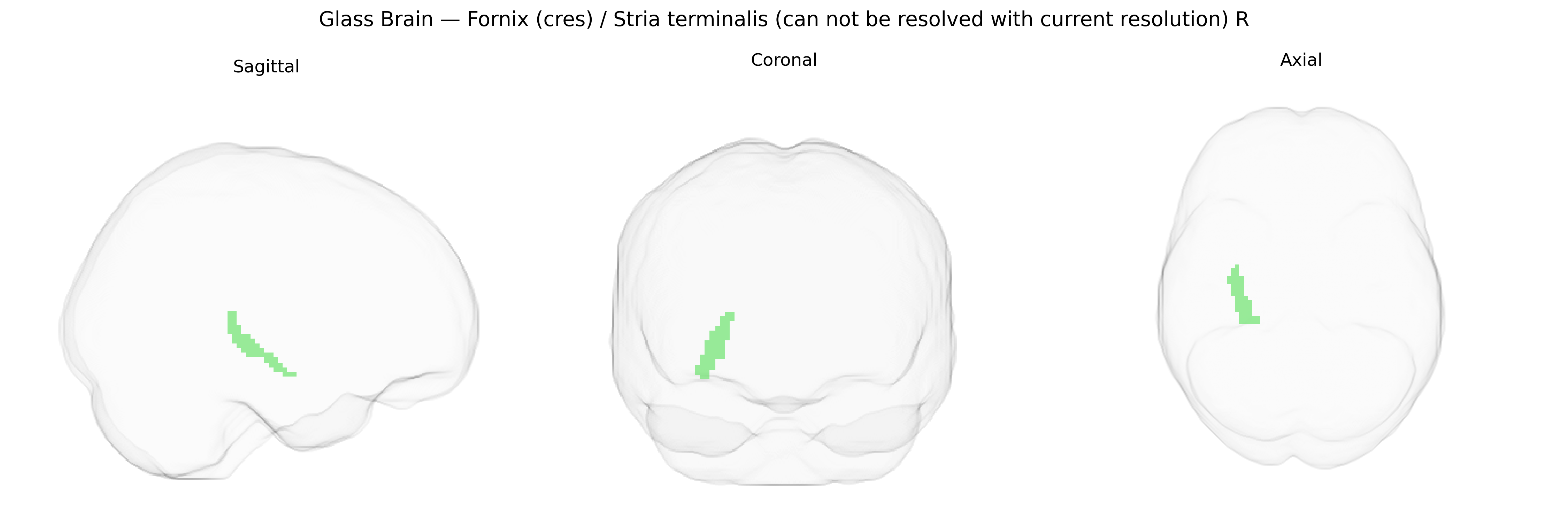 Triplanar Ghost Brain