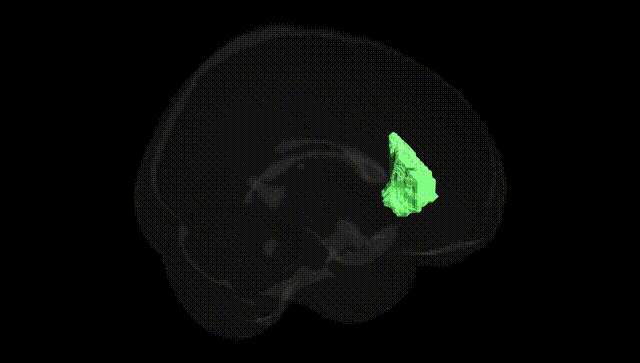 Full Brain Black
