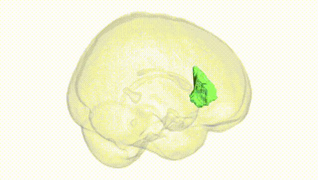 Full Brain White
