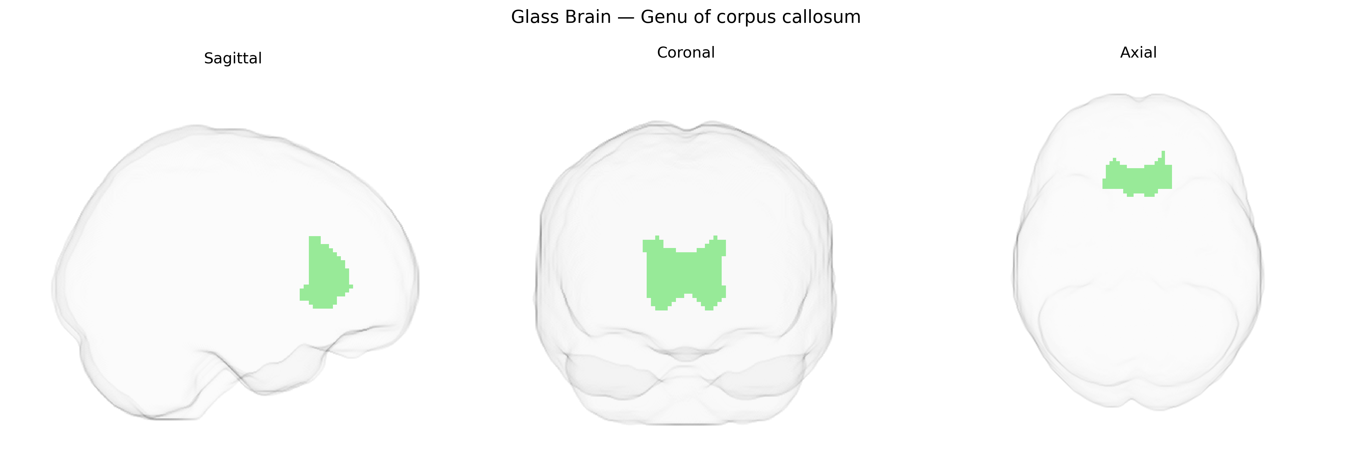Triplanar Ghost Brain