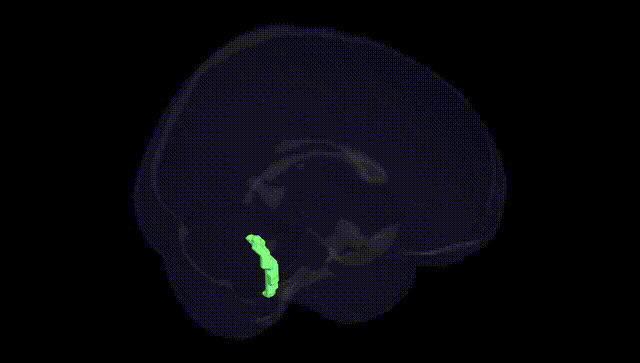 Full Brain Black