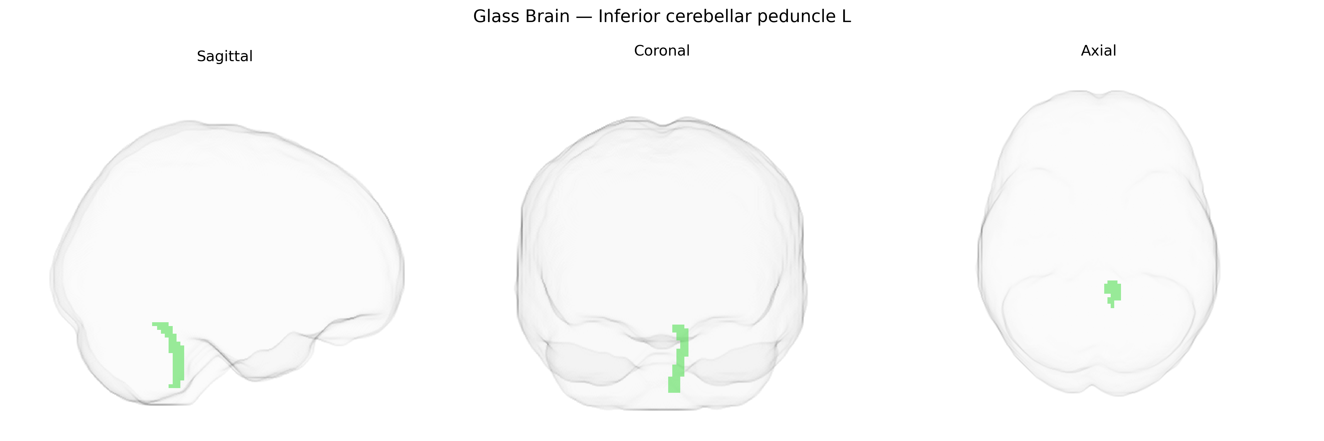 Triplanar Ghost Brain