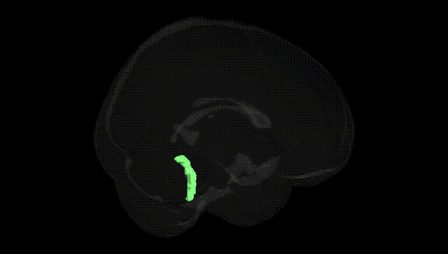 Full Brain Black