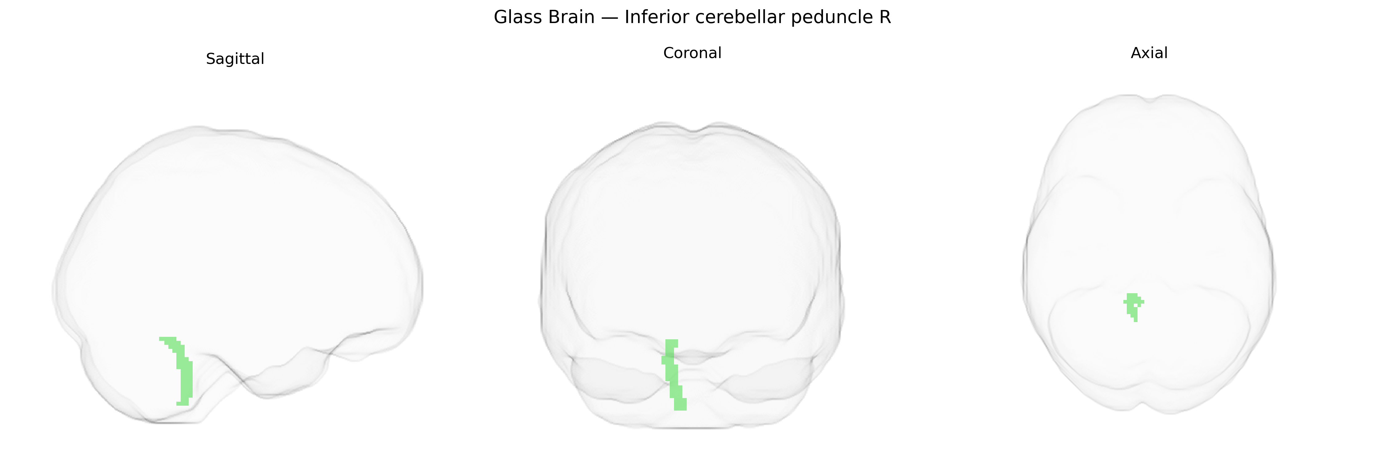 Triplanar Ghost Brain