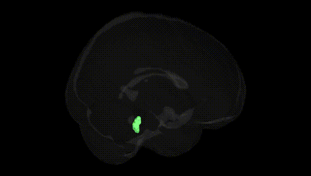Full Brain Black