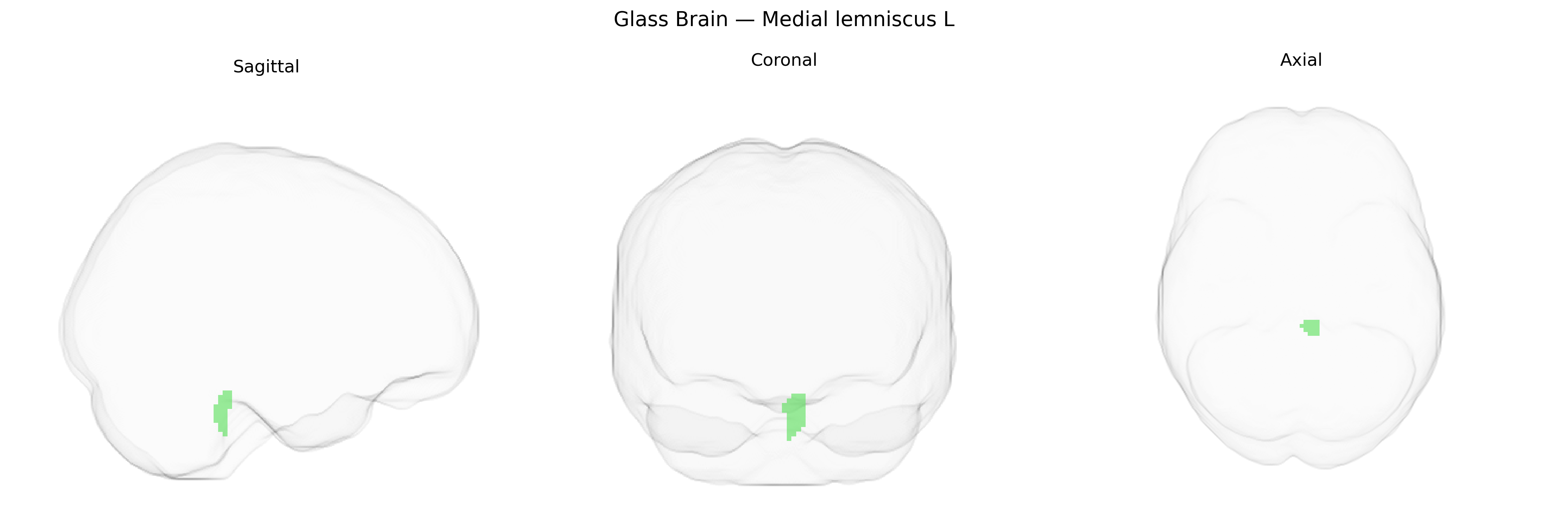 Triplanar Ghost Brain