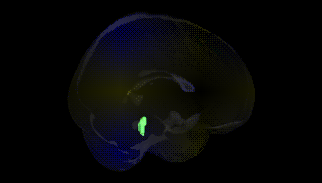 Full Brain Black