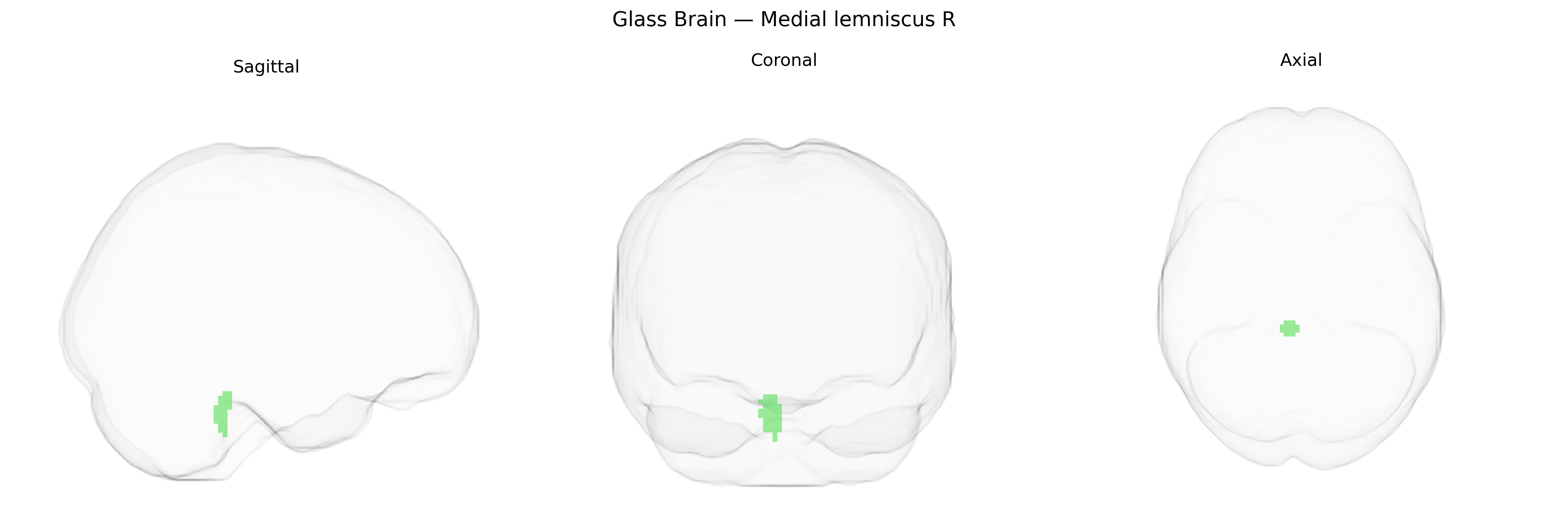 Triplanar Ghost Brain