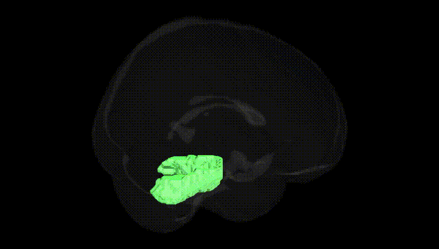 Full Brain Black