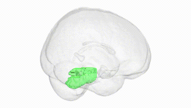 Full Brain White