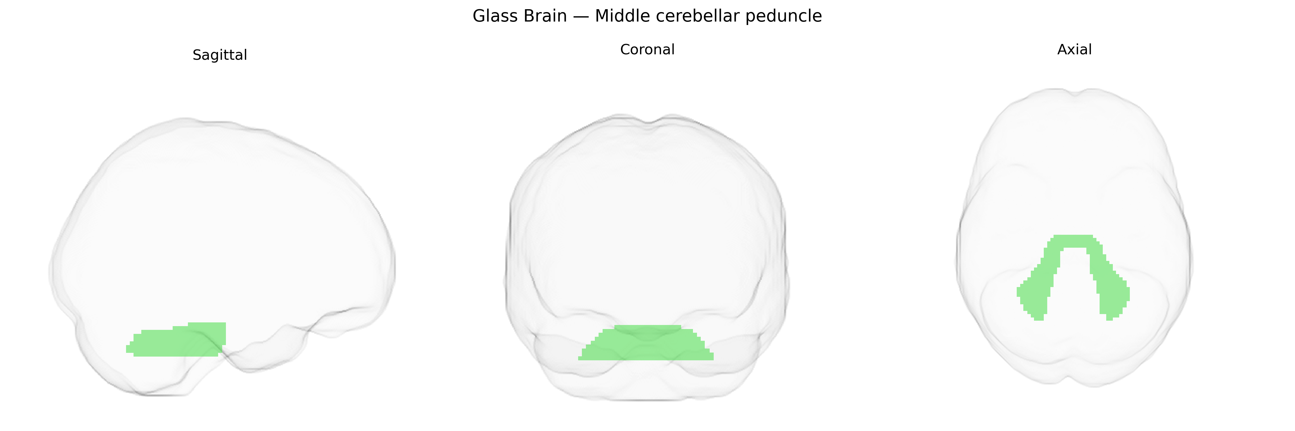 Triplanar Ghost Brain