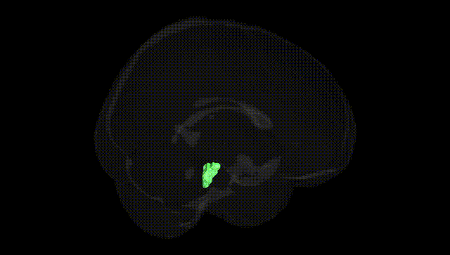 Full Brain Black