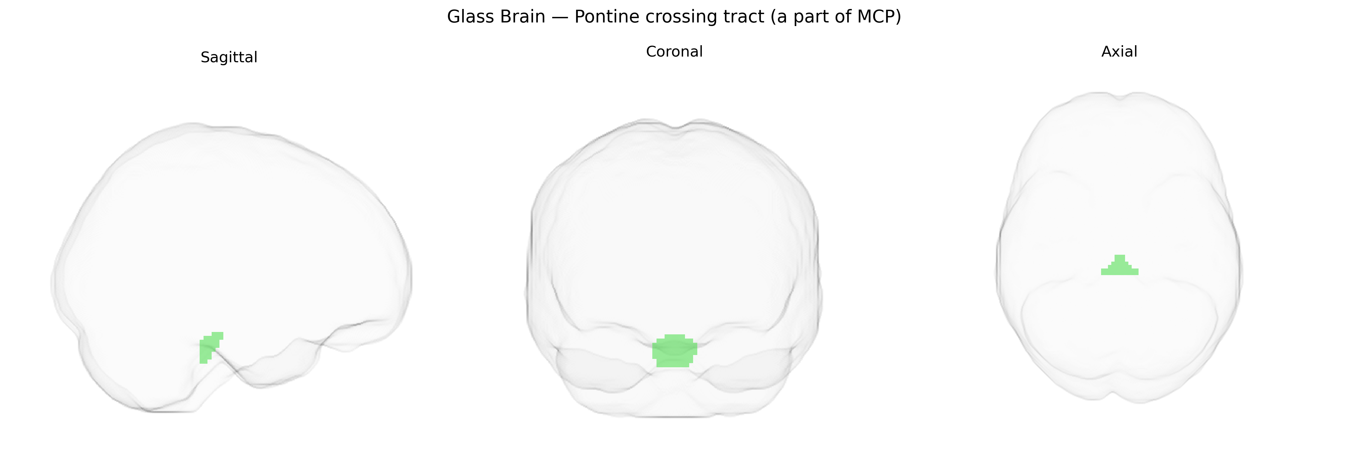 Triplanar Ghost Brain