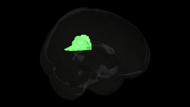 Full Brain Black
