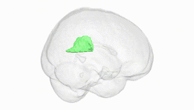Full Brain White