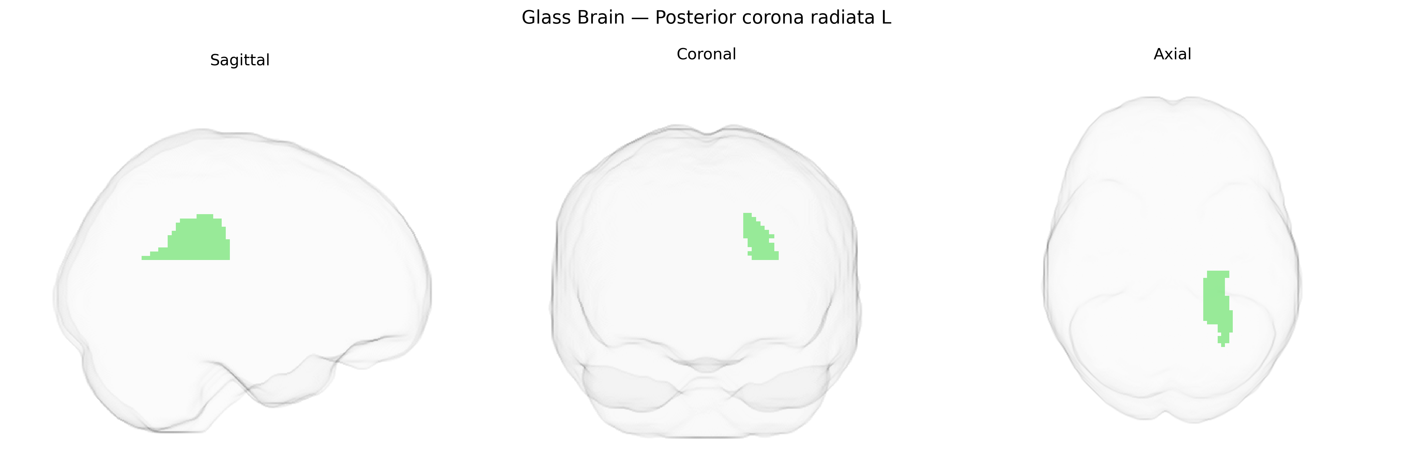 Triplanar Ghost Brain