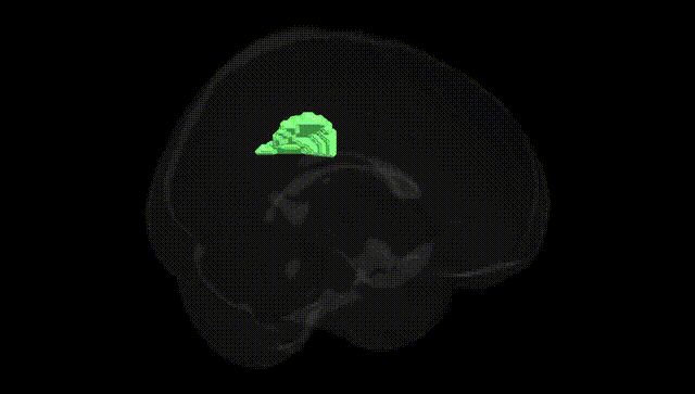 Full Brain Black