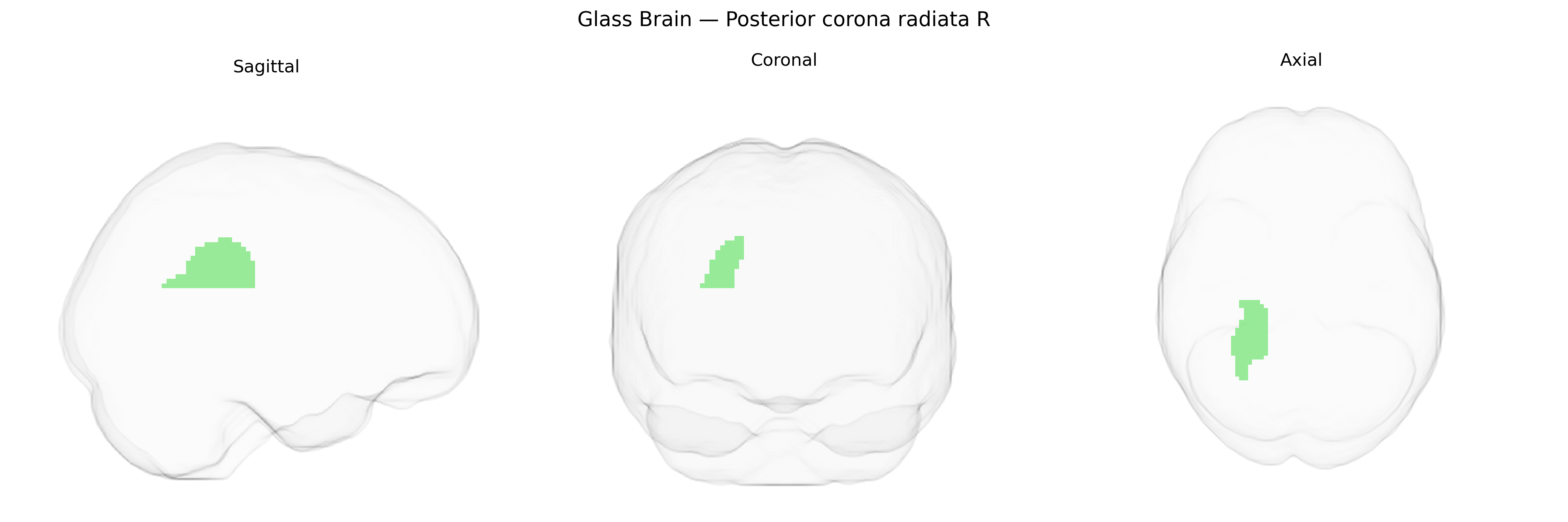Triplanar Ghost Brain