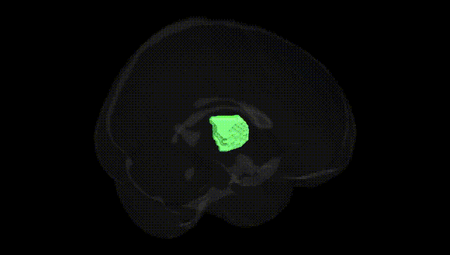 Full Brain Black