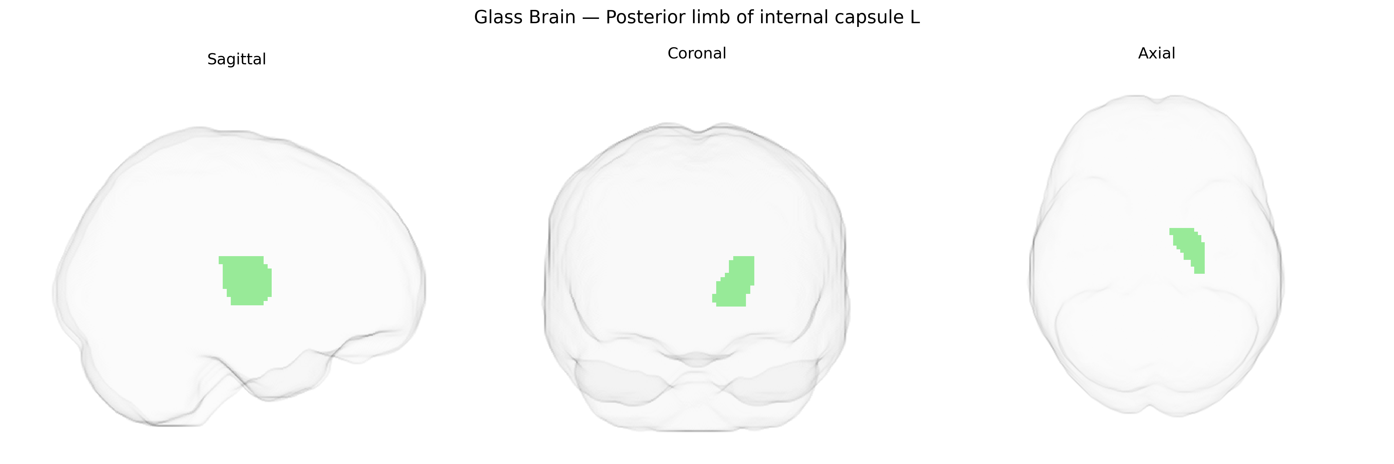 Triplanar Ghost Brain