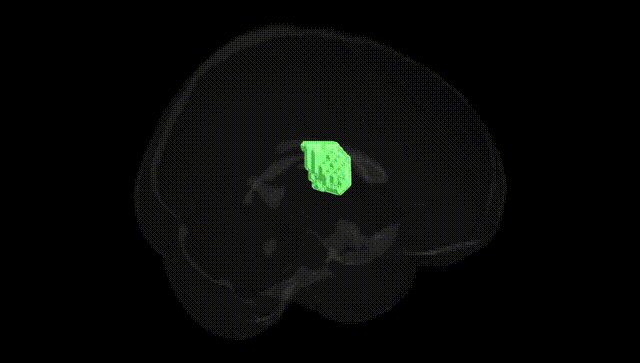 Full Brain Black