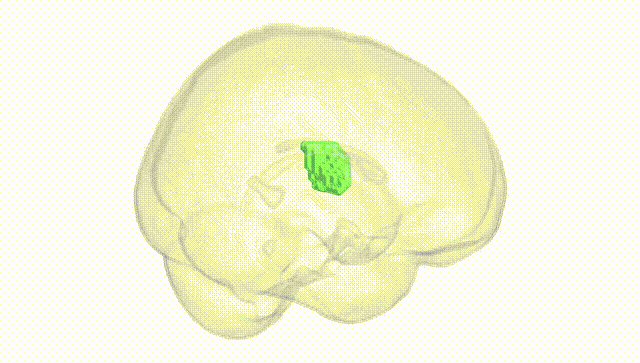 Full Brain White