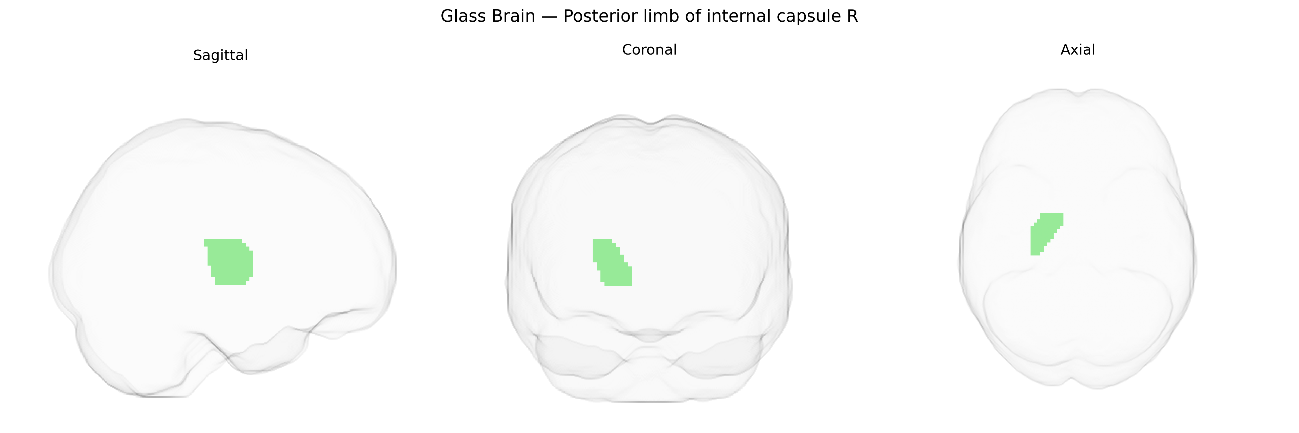 Triplanar Ghost Brain