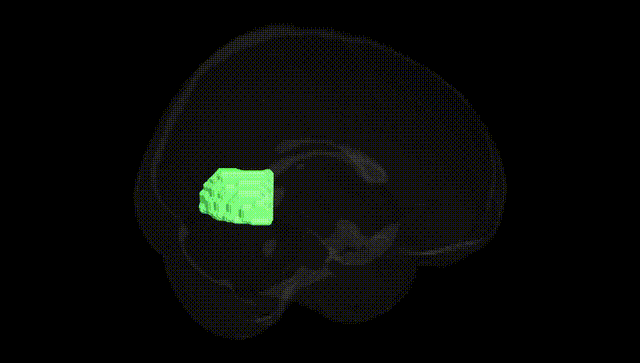 Full Brain Black