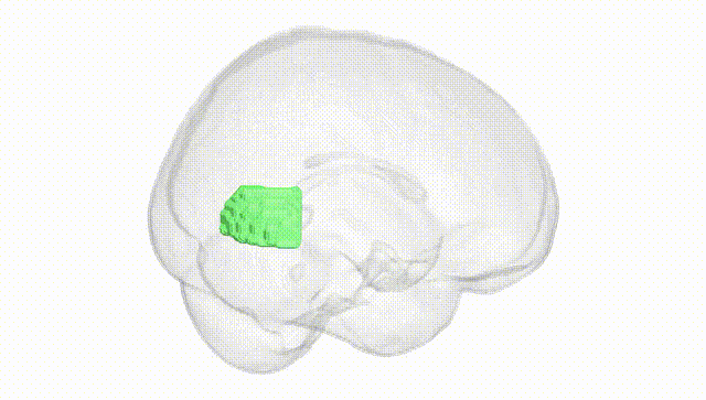 Full Brain White