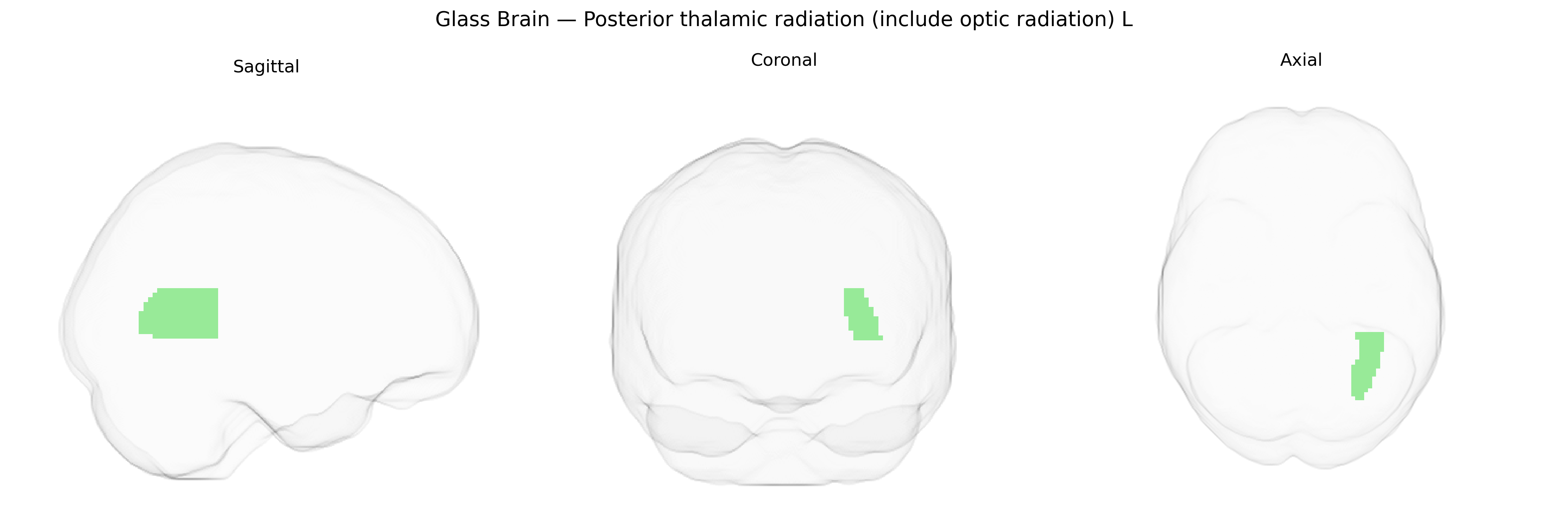 Triplanar Ghost Brain