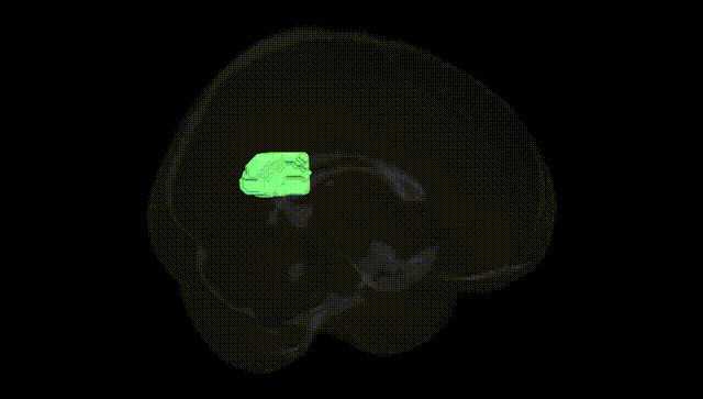 Full Brain Black
