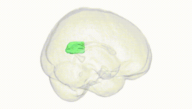 Full Brain White