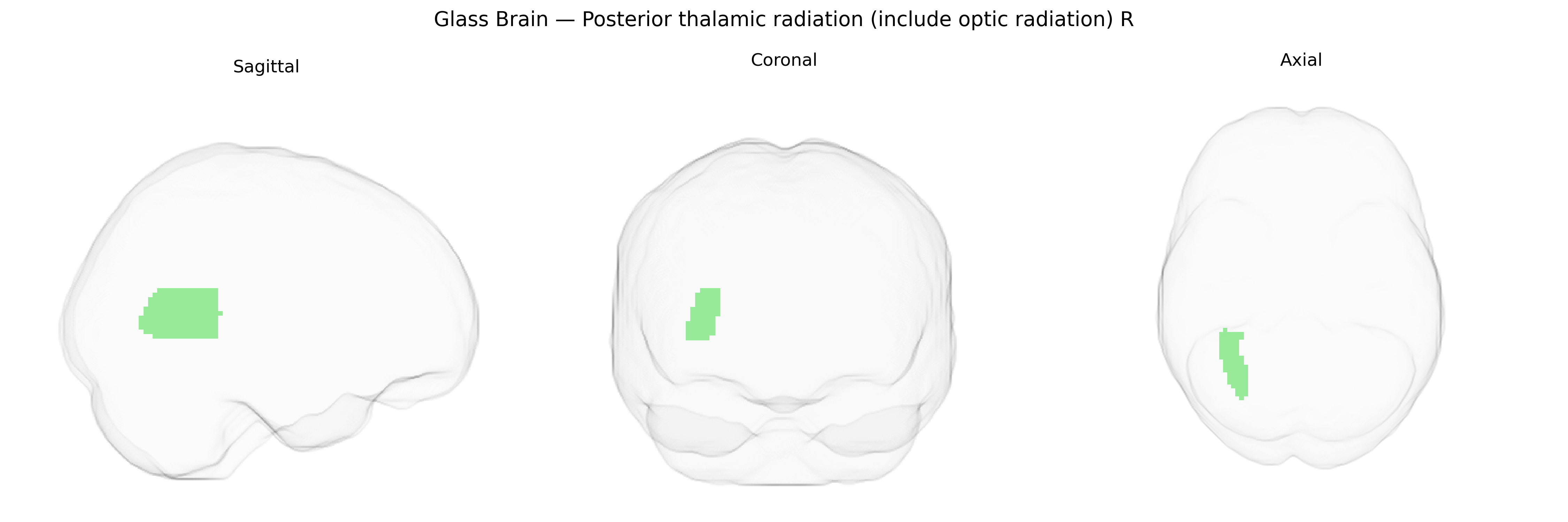 Triplanar Ghost Brain