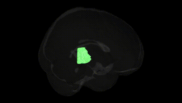 Full Brain Black