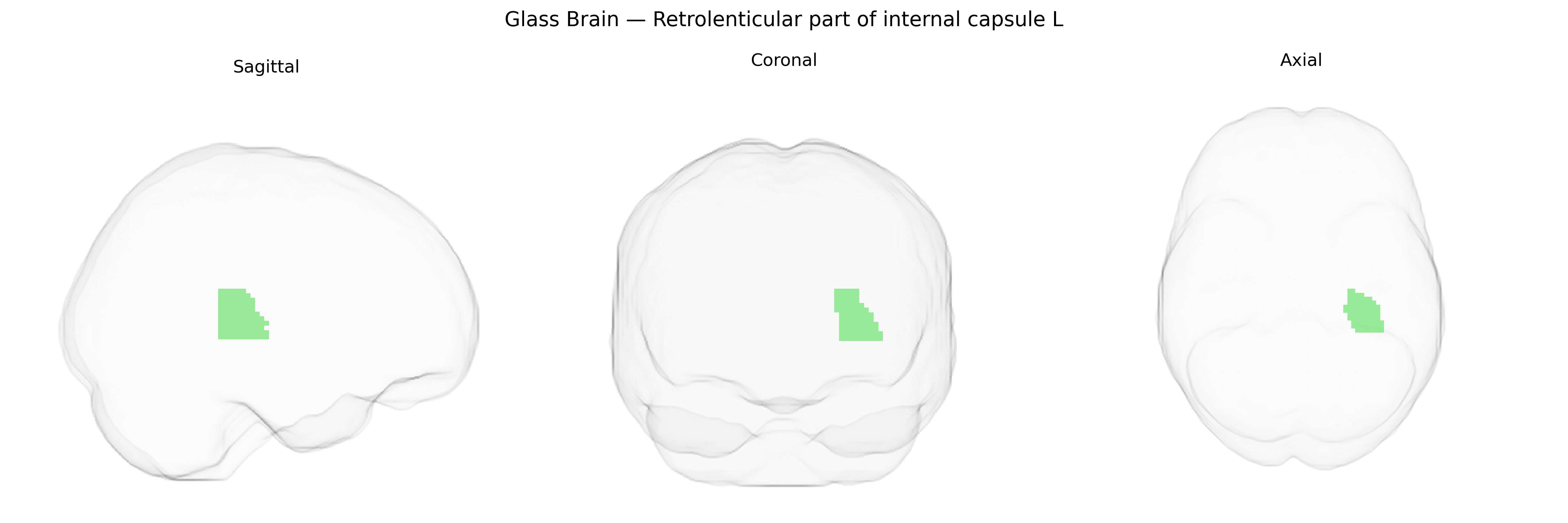 Triplanar Ghost Brain