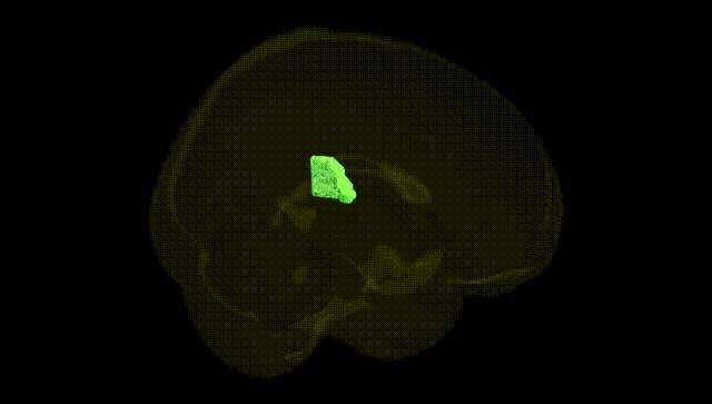 Full Brain Black