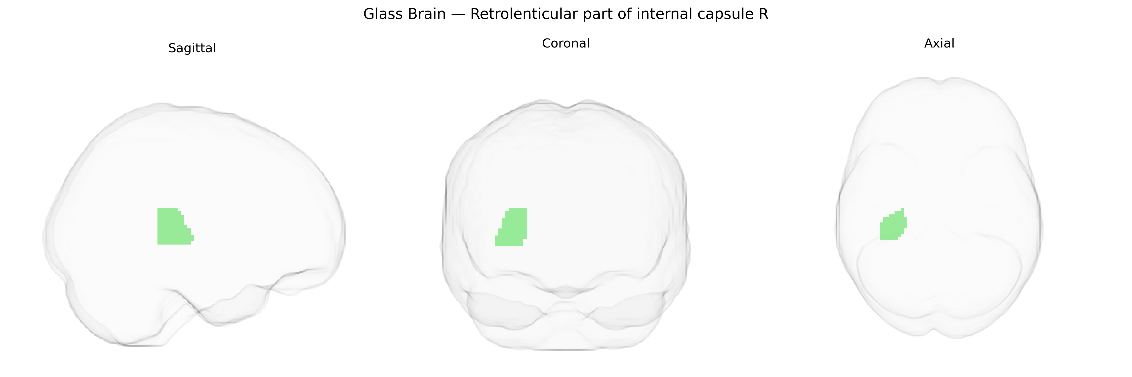 Triplanar Ghost Brain