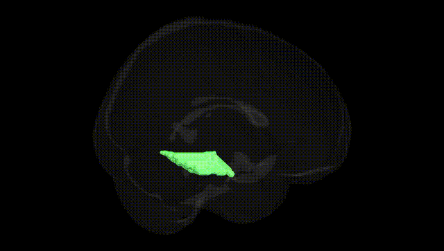 Full Brain Black