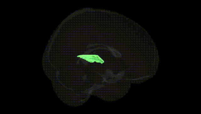 Full Brain Black